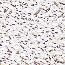 Invitrogen RAD21 Polyclonal Antibody 100 &mu;L; Unconjugated:Antibodies,