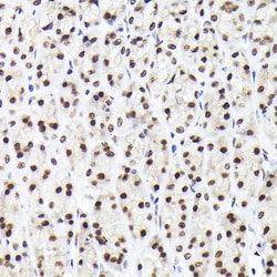 Invitrogen RAD21 Polyclonal Antibody 100 &mu;L; Unconjugated:Antibodies,