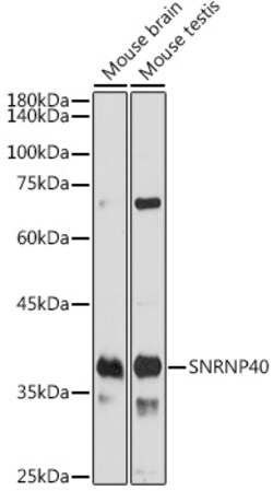 Invitrogen SNRNP40 Polyclonal Antibody 100 &mu;L; Unconjugated:Antibodies,