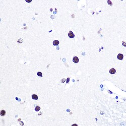 Invitrogen hnRNP C Polyclonal Antibody 100 &mu;L; Unconjugated:Antibodies,