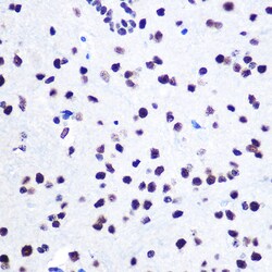 Invitrogen hnRNP C Polyclonal Antibody 100 &mu;L; Unconjugated:Antibodies,
