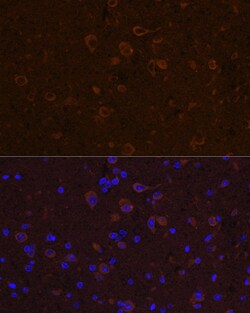 Invitrogen CNTF Polyclonal Antibody 100 &mu;L; Unconjugated:Antibodies,