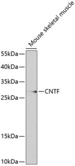 Invitrogen CNTF Polyclonal Antibody 100 &mu;L; Unconjugated:Antibodies,