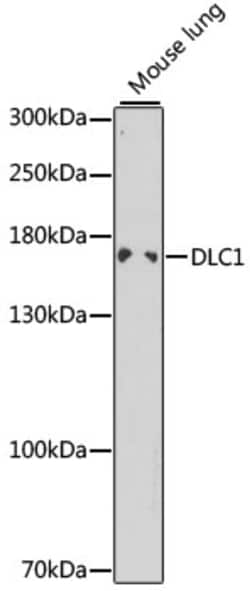 Invitrogen DLC1 Polyclonal Antibody 100 &mu;L; Unconjugated:Antibodies,