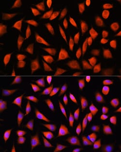 Invitrogen RhoG Polyclonal Antibody 100 &mu;L; Unconjugated:Antibodies,