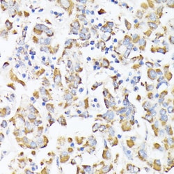 Invitrogen RhoG Polyclonal Antibody 100 &mu;L; Unconjugated:Antibodies,