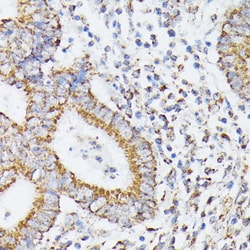 Invitrogen RhoG Polyclonal Antibody 100 &mu;L; Unconjugated:Antibodies,