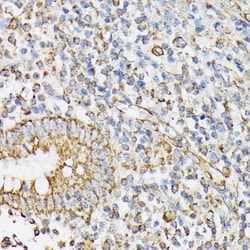 Invitrogen RhoG Polyclonal Antibody 100 &mu;L; Unconjugated:Antibodies,