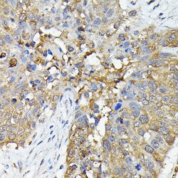 Invitrogen Caspase 4 Polyclonal Antibody 100 &mu;L; Unconjugated:Antibodies,