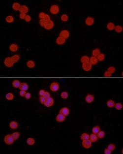 Invitrogen S100A10 Polyclonal Antibody 100 &mu;L; Unconjugated:Antibodies,