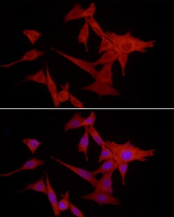 Invitrogen S100A10 Polyclonal Antibody 100 &mu;L; Unconjugated:Antibodies,