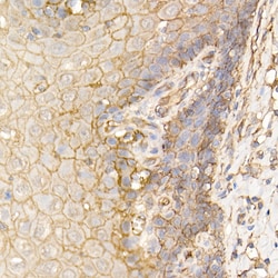 Invitrogen S100A10 Polyclonal Antibody 100 &mu;L; Unconjugated:Antibodies,