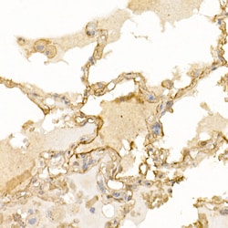 Invitrogen S100A10 Polyclonal Antibody 100 &mu;L; Unconjugated:Antibodies,