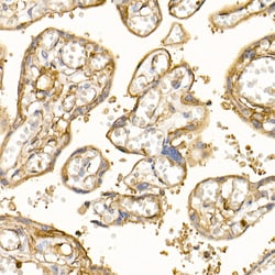 Invitrogen S100A10 Polyclonal Antibody 100 &mu;L; Unconjugated:Antibodies,