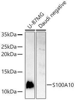 Invitrogen S100A10 Polyclonal Antibody 100 &mu;L; Unconjugated:Antibodies,