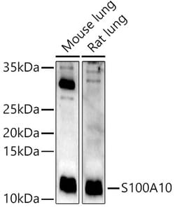 Invitrogen S100A10 Polyclonal Antibody 100 &mu;L; Unconjugated:Antibodies,