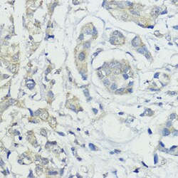 Invitrogen CDw293 Polyclonal Antibody 100 &mu;L; Unconjugated:Antibodies,