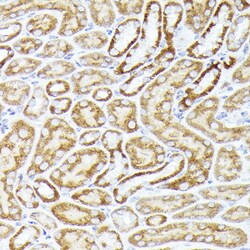 Invitrogen CDw293 Polyclonal Antibody 100 &mu;L; Unconjugated:Antibodies,