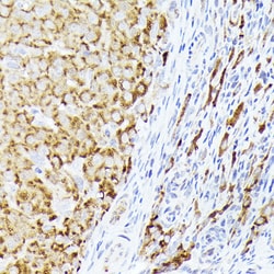 Invitrogen CDw293 Polyclonal Antibody 100 &mu;L; Unconjugated:Antibodies,