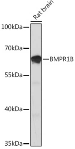 Invitrogen CDw293 Polyclonal Antibody 100 &mu;L; Unconjugated:Antibodies,