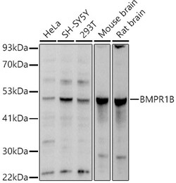 Invitrogen CDw293 Polyclonal Antibody 100 &mu;L; Unconjugated:Antibodies,