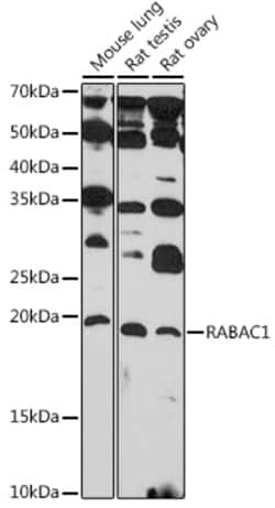 Invitrogen RABAC1 Polyclonal Antibody 100 &mu;L; Unconjugated:Antibodies,