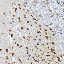 Invitrogen MT2A Polyclonal Antibody 100 &mu;L; Unconjugated:Antibodies,