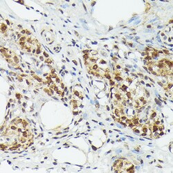 Invitrogen MT2A Polyclonal Antibody 100 &mu;L; Unconjugated:Antibodies,