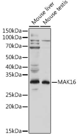 Invitrogen MAK16 Polyclonal Antibody 100 &mu;L | Buy Online | Invitrogen&trade; | Fisher Scientific