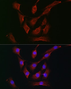 Invitrogen RSK1/RSK2/RSK3 Polyclonal Antibody 100 &mu;L; Unconjugated:Antibodies,
