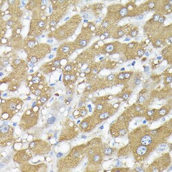 Invitrogen RSK1/RSK2/RSK3 Polyclonal Antibody 100 &mu;L; Unconjugated:Antibodies,