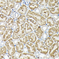 Invitrogen RSK1/RSK2/RSK3 Polyclonal Antibody 100 &mu;L; Unconjugated:Antibodies,