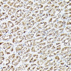 Invitrogen RSK1/RSK2/RSK3 Polyclonal Antibody 100 &mu;L; Unconjugated:Antibodies,