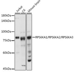 Invitrogen RSK1/RSK2/RSK3 Polyclonal Antibody 100 &mu;L; Unconjugated:Antibodies,