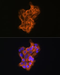 Invitrogen RAB11A/RAB11B Polyclonal Antibody 100 &mu;L; Unconjugated:Antibodies,