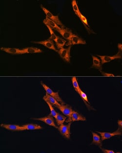 Invitrogen RAB11A/RAB11B Polyclonal Antibody 100 &mu;L; Unconjugated:Antibodies,