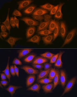 Invitrogen RAB11A/RAB11B Polyclonal Antibody 100 &mu;L; Unconjugated:Antibodies,