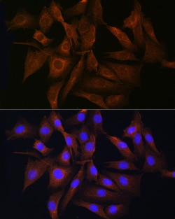 Invitrogen RAB11A/RAB11B Polyclonal Antibody 100 &mu;L; Unconjugated:Antibodies,