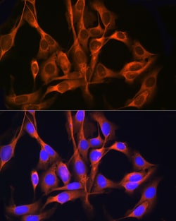 Invitrogen RAB11A/RAB11B Polyclonal Antibody 100 &mu;L; Unconjugated:Antibodies,