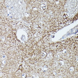 Invitrogen RAB11A/RAB11B Polyclonal Antibody 100 &mu;L; Unconjugated:Antibodies,