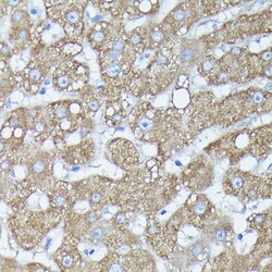 Invitrogen RAB11A/RAB11B Polyclonal Antibody 100 &mu;L; Unconjugated:Antibodies,