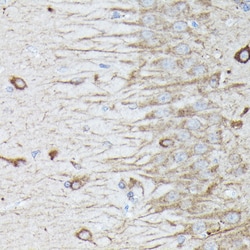 Invitrogen RAB11A/RAB11B Polyclonal Antibody 100 &mu;L; Unconjugated:Antibodies,