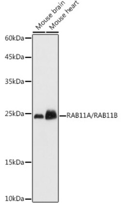 Invitrogen RAB11A/RAB11B Polyclonal Antibody 100 &mu;L; Unconjugated:Antibodies,