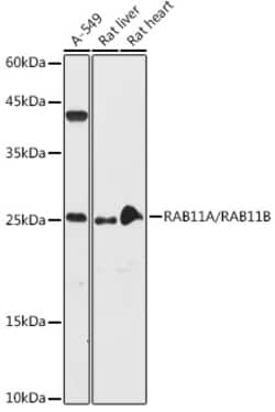 Invitrogen RAB11A/RAB11B Polyclonal Antibody 100 &mu;L; Unconjugated:Antibodies,