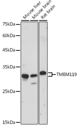 Invitrogen TMEM119 Polyclonal Antibody 100 &mu;L; Unconjugated:Antibodies,