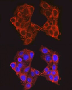 Invitrogen PCK1 Polyclonal Antibody 100 &mu;L; Unconjugated:Antibodies,