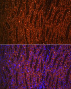 Invitrogen PCK1 Polyclonal Antibody 100 &mu;L; Unconjugated:Antibodies,