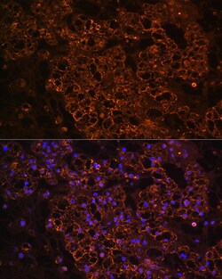Invitrogen PCK1 Polyclonal Antibody 100 &mu;L; Unconjugated:Antibodies,