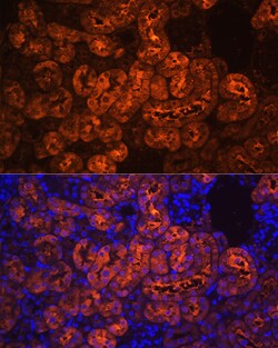 Invitrogen PCK1 Polyclonal Antibody 100 &mu;L; Unconjugated:Antibodies,