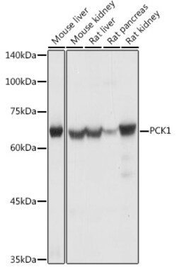 Invitrogen PCK1 Polyclonal Antibody 100 &mu;L; Unconjugated:Antibodies,